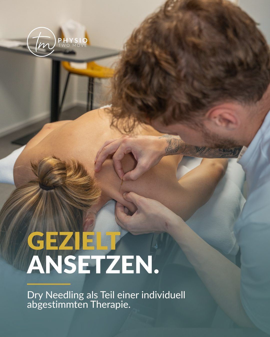 Dry Needling Behandlung bei Physio Two Move